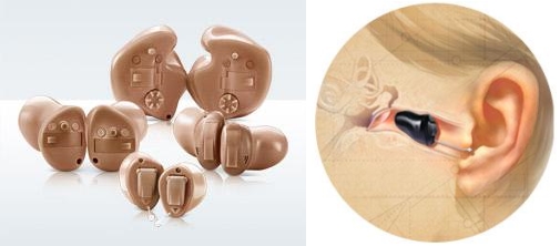 hearing aids in Delhi